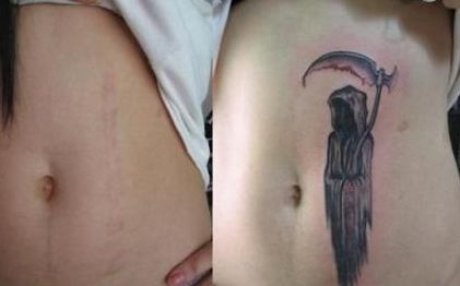 南京哪家醫(yī)院做隆鼻好？選擇哪家醫(yī)院效果最好，價格又合理又安全