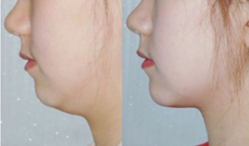 山東臨沂整容醫(yī)院排行榜及綜合評(píng)價(jià)：哪家好？