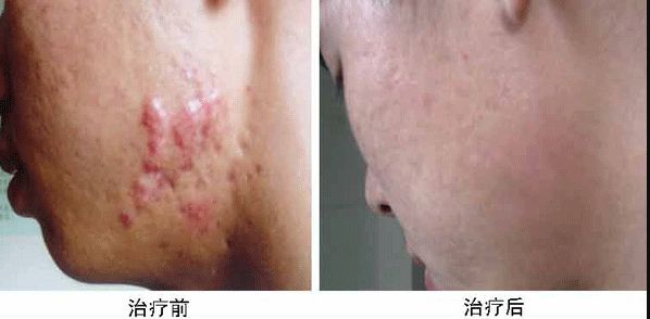 合肥哪家整容醫(yī)院雙眼皮做得好？專業(yè)整形外科專家推薦