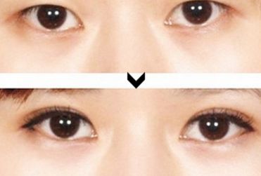 寧夏整形醫(yī)院哪家好？綜合評測，推薦您最滿意的整形醫(yī)院