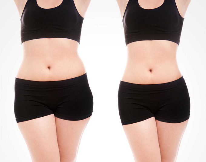 2023廣州頸紋填充嗨體正規(guī)醫(yī)生口碑(王志軍、伍明政、李翠華全新實力曝光)