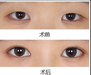 鄭州去黑點(diǎn)哪家醫(yī)院好？揭秘最受歡迎的黑點(diǎn)去除醫(yī)院