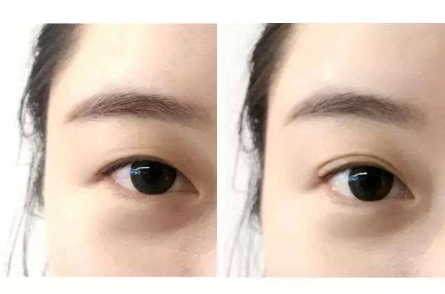 2023北京針清祛痘印口碑好的醫(yī)生(郭卉、潘峰、趙京玉憑技術(shù)蟬聯(lián)前幾！)