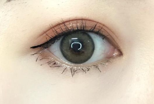 如何評(píng)價(jià)深圳和協(xié)醫(yī)院的脂肪填充手術(shù)？費(fèi)用是多少？醫(yī)生資質(zhì)如何？