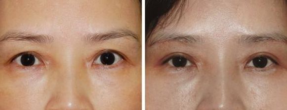 上海激光美容醫(yī)院排名及熱門選擇，哪家好？