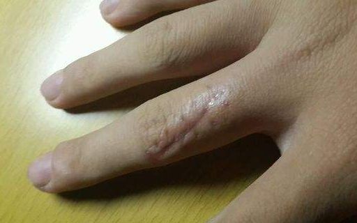 上海哪家醫(yī)院做肋骨鼻子整形手術(shù)好？