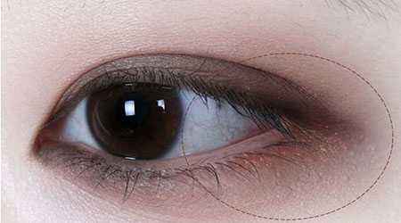 2023濟(jì)南5s重瞼術(shù)權(quán)威醫(yī)生口碑TOP10(于杰、張義晨、王標(biāo)多方面出擊入圍榜單)