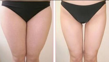 如何評(píng)價(jià)廣州珈禾整形醫(yī)院的口碑和質(zhì)量？