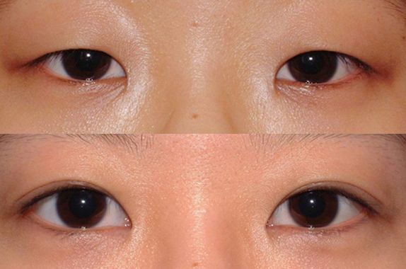 蘇州打瘦臉針哪家醫(yī)院好？2023年蘇州瘦臉針治療排行榜發(fā)布