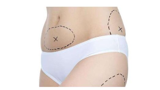 上海哪家醫(yī)院的祛眼袋手術(shù)效果最好？讓您的眼睛重獲明亮與青春