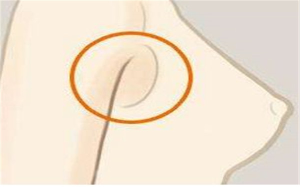 范巨峰醫(yī)生個(gè)人故事：驚艷雙眼皮案例與專(zhuān)業(yè)實(shí)力！