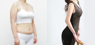 成都做雙眼皮，哪家醫(yī)院專業(yè)可靠？