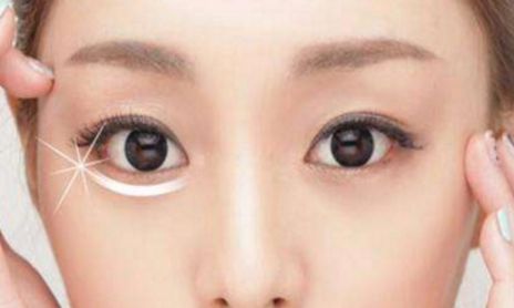 荊州割眼袋哪家醫(yī)院好？眼袋修復(fù)專(zhuān)家為您推薦！