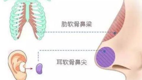 廣州有哪些醫(yī)院可以進(jìn)行抽脂手術(shù)？
