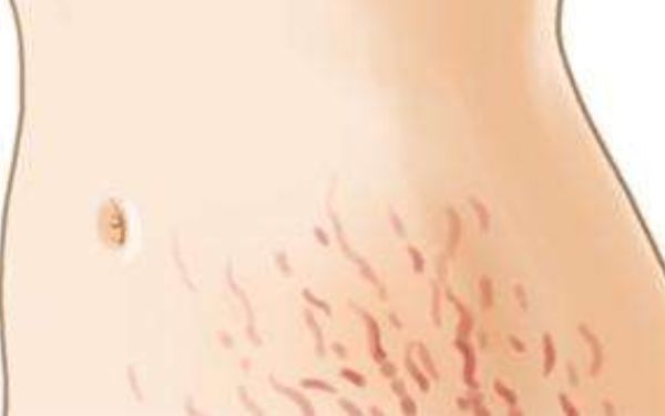 新鄉(xiāng)海迪醫(yī)療整形美容醫(yī)院值得信賴嗎？2023年價格表與醫(yī)生信息一覽