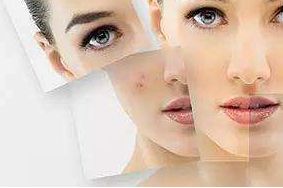 上海哪家醫(yī)院祛太田痣效果最佳？