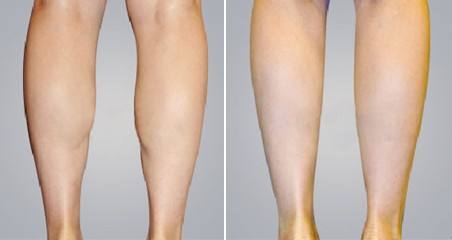 2023南京面部溶脂術(shù)正規(guī)專(zhuān)家榜單TOP10強(qiáng)(朱儒勝、趙霞、王艷實(shí)力及口碑出爐)