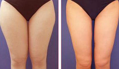 杭州去除雀斑哪家醫(yī)院好？天堂醫(yī)美專業(yè)美容師傾情解答！