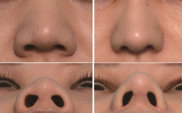 湖州市哪家醫(yī)院去疤痕好？專家推薦疤痕修復技術排行榜！