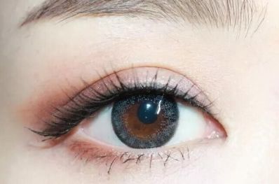 如何選擇德陽切開雙眼皮專家？評估這些因素找到最好的醫(yī)院！