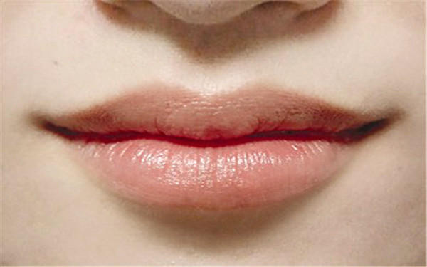 2023廈門肉毒素印第安紋注射醫(yī)生口碑10強(qiáng)(陳國(guó)鼎、楊協(xié)貴、喻志宏沖進(jìn)前三)