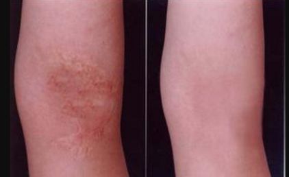 重慶整形醫(yī)院哪家效果好？權威排行榜來告訴你！