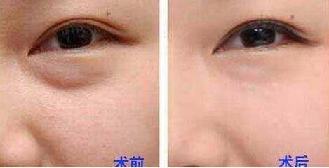 杭州整形美容界大咖PK，曾海峰、河?xùn)|鎬、高俊明，想知道磨骨哪個(gè)醫(yī)生靠譜？