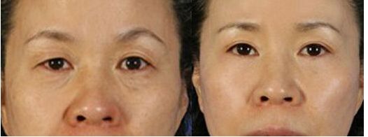 南京硅膠隆鼻哪家醫(yī)院好？斯景醫(yī)療專(zhuān)家推薦！