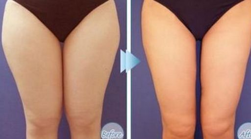 哪位醫(yī)生在北京八大處做拉皮手術(shù)效果好？馬繼光的資歷和費用情況有哪些？