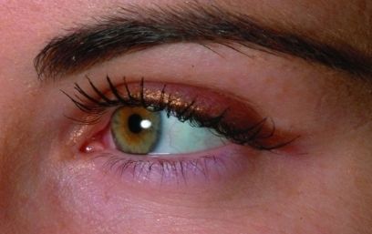 上海哪家醫(yī)院治療疤痕效果好？上海三甲疤痕醫(yī)院哪家最受歡迎？