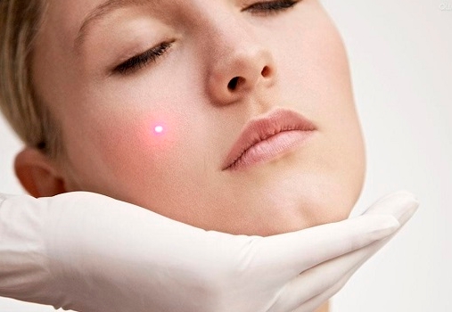 2023上海韓式下頜角瘦臉正規(guī)醫(yī)生排行前幾(陳春水、王海、李衡華技術(shù)成熟優(yōu)勢(shì)多)