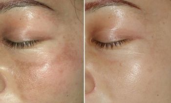 哈醫(yī)大二院整形科怎么樣？哈醫(yī)大二院整形科簡(jiǎn)介|醫(yī)生團(tuán)隊(duì)|口碑評(píng)價(jià)！