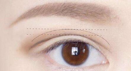 杭州劉軍鼻子塑形效果如何？個(gè)人簡(jiǎn)介、醫(yī)院、費(fèi)用詳情先給您解答