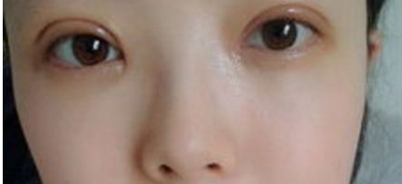 重慶隆鼻整形排名前三的醫(yī)院有哪些？