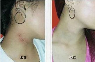 南寧哪家醫(yī)院治痘效果好？選擇明星們的美肌秘密推薦的南寧優(yōu)質(zhì)醫(yī)院