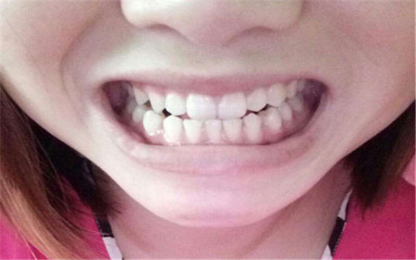 2023聊城脂肪抬頭紋填充正規(guī)專家口碑前十(楊盼、劉通、班安華更專業(yè)！)