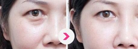 北京哪位醫(yī)生擅長巨乳縮小手術(shù)？5名實(shí)力醫(yī)生值得推薦