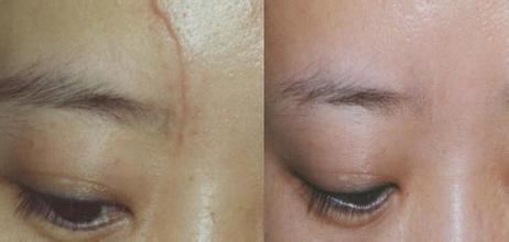 2023南京額頭皺紋快速消除專家前10名上榜清單(陳訓、沈干、陳晨強勢推薦~)