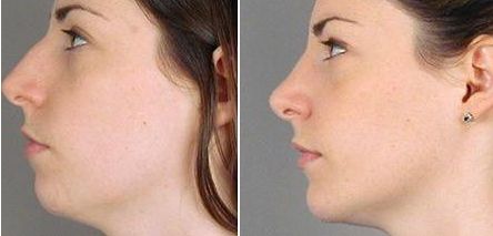 上?？簇惪损肽募裔t(yī)院好？選個(gè)靠譜的！