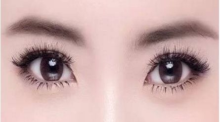 南寧自體填充淚溝哪家好？探索最佳南寧自體填充淚溝選擇