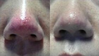 福州哪家醫(yī)生做隆胸技術(shù)好？推薦五位專業(yè)醫(yī)師，價(jià)格參考！