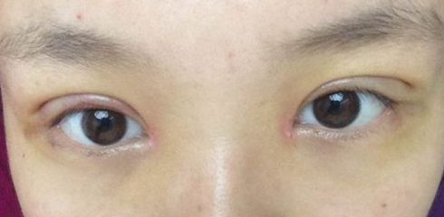 徐州做拉皮哪家醫(yī)院好？一起來看看徐州市最受歡迎的做拉皮醫(yī)院