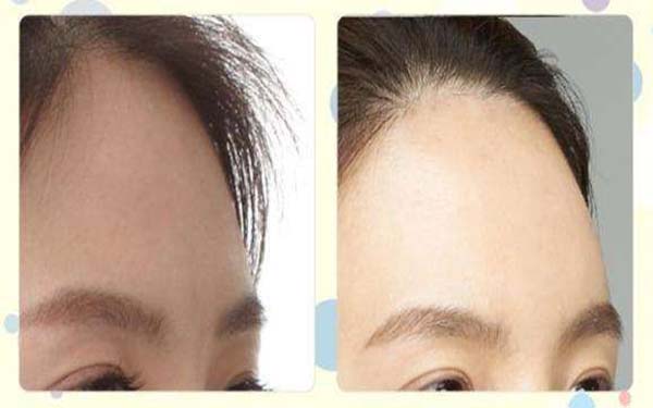 全國(guó)整容醫(yī)生PHD公開(kāi)名單，創(chuàng)新技術(shù)行業(yè)新標(biāo)桿