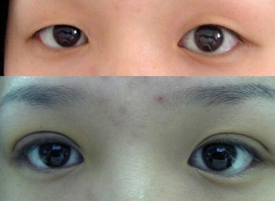 南京的正規(guī)整形醫(yī)院排名2023南京最好的整形醫(yī)院推薦