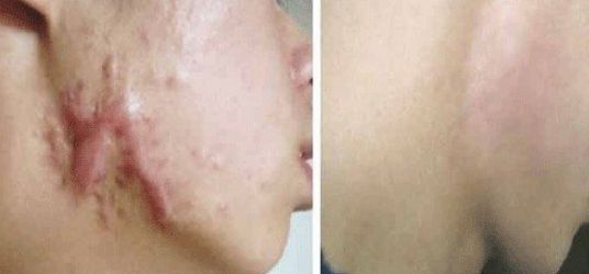 ?？谑姓吾t(yī)院哪家好？專家推薦最具口碑的?？谡吾t(yī)院有哪些？