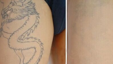 南京哪家醫(yī)院做面部提升效果最好？