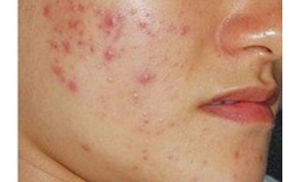 想了解寧波慈溪圣愛(ài)醫(yī)院醫(yī)療美容整形科價(jià)格表？醫(yī)生口碑如何？