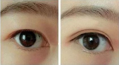 合肥哪家整形醫(yī)院好口碑好服務(wù)好值得推薦？