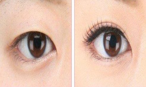 南昌市哪家醫(yī)院去痘好？專家推薦的南昌市治療痘痘的一流醫(yī)院有哪些