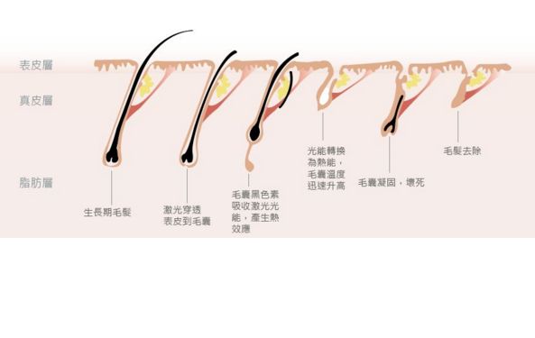 深圳哪家激光祛斑醫(yī)院口碑好？